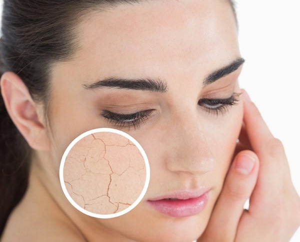 Điều gì sẽ xảy ra nếu cơ thể bị mất cân bằng nước?